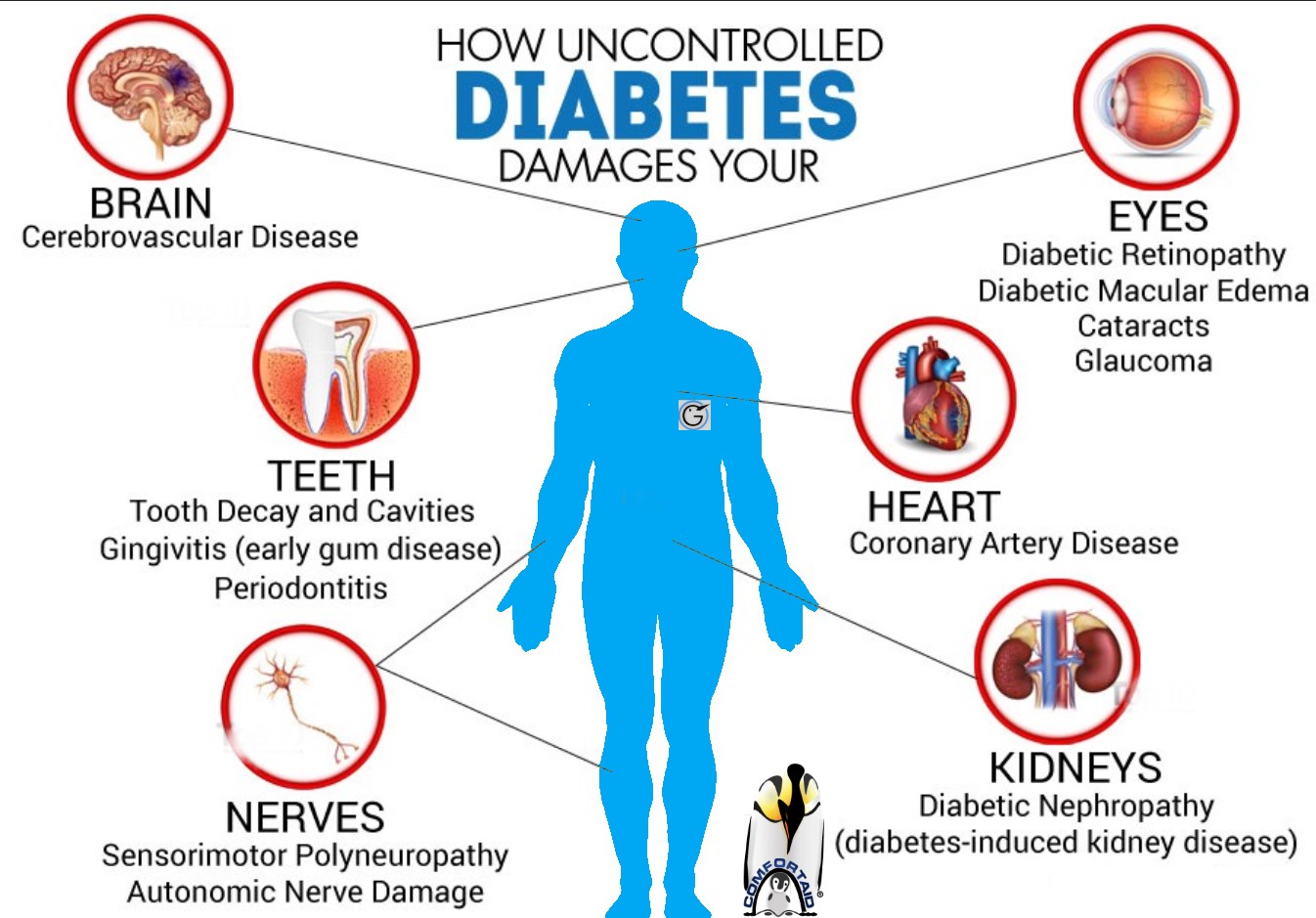 juvenile-diabetes-possible-complications-gluxus-health-comfortaid